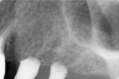 1  800x600  ezjmli - Eugenol