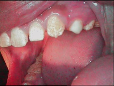 1bis gqoz5j - Eugenol