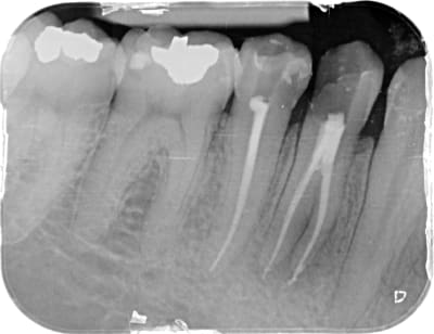 1osff7kk16ybclkejie7yhaqia0r - Eugenol