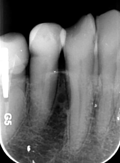 20 07 15 ojrfrq - Eugenol