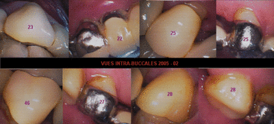 2005 iib 02 fe9zdt - Eugenol