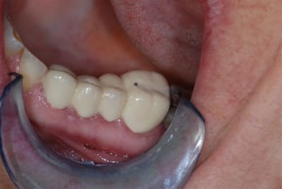 2007 09 10 005 q11t9i - Eugenol