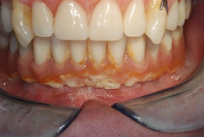 2009 03 16 013 ryt0v7 - Eugenol