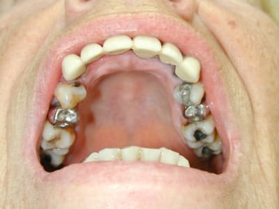 2009 11 26 kj53m2 - Eugenol