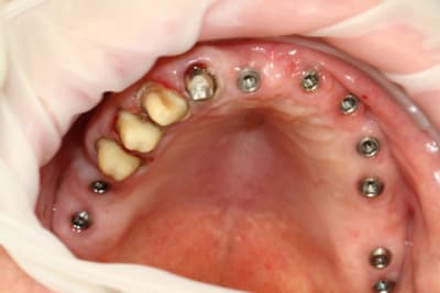 2010 04 20 0164r d0jxbf - Eugenol