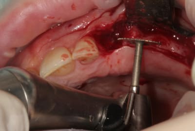 2010 05 28 0295r vx5btm - Eugenol