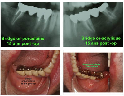 2011 06 01 205223 bhpebb - Eugenol