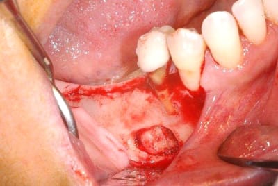 2011 07 01b 005 pehp2n - Eugenol