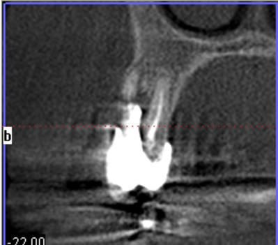 2011 09 15 110154 ls4p4p - Eugenol