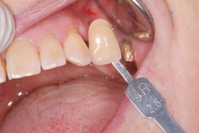 2011 11 04 002 wbgwvg - Eugenol