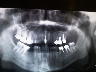 20140115 090349 c7seau - Eugenol