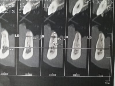 20141125 142307 z6qmcr - Eugenol