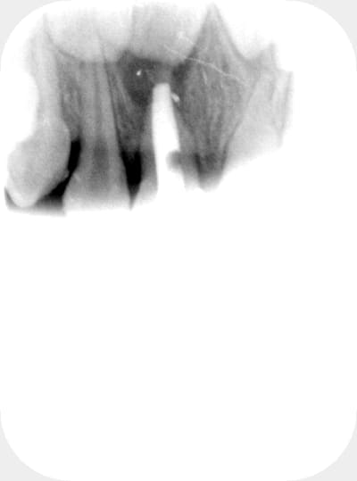 2014 endo bfptqc - Eugenol