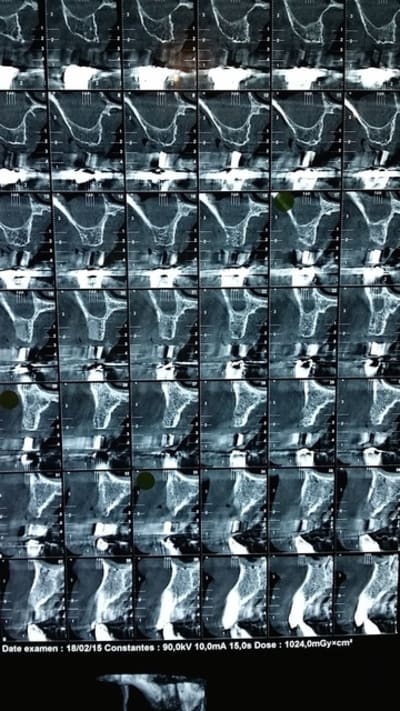 20150220 092048 psryxk - Eugenol