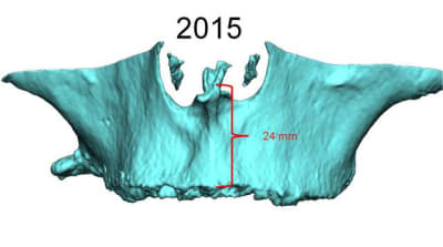 2015 pw4ie8 - Eugenol