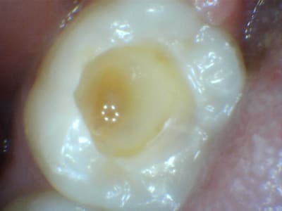 2019 03 16 090940 u66yjc - Eugenol