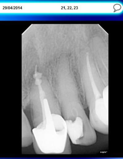 21 22 23 n0dck0 - Eugenol