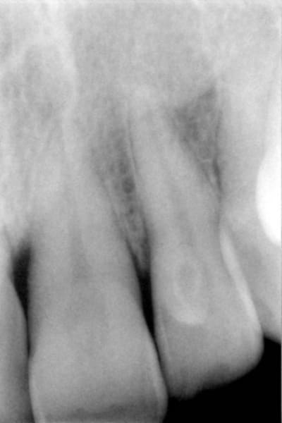 21 22 xpkczr - Eugenol