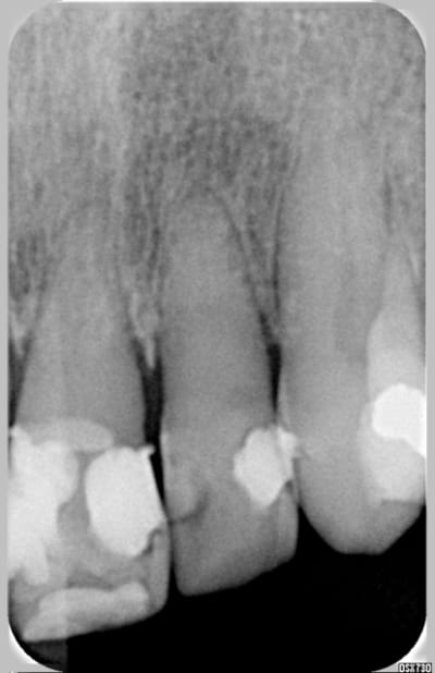 21 en 2003 forz7a - Eugenol