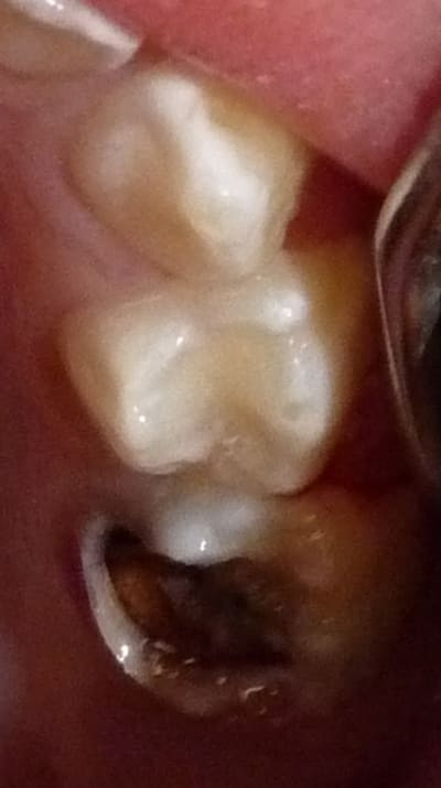 21 ytexa6 - Eugenol