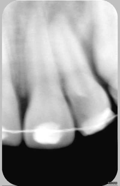 22 21 19 4 2006 ziujyh - Eugenol