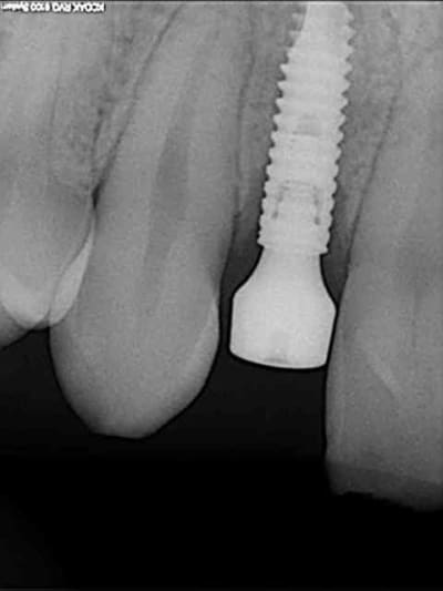 23 12 2009 cs5zdv - Eugenol