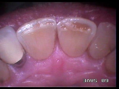 234 wn8zaa - Eugenol