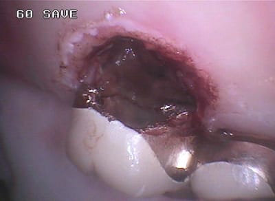 237 i9mxbn - Eugenol