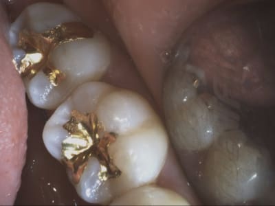 2490 video 20180308 142047 kjkhgw - Eugenol