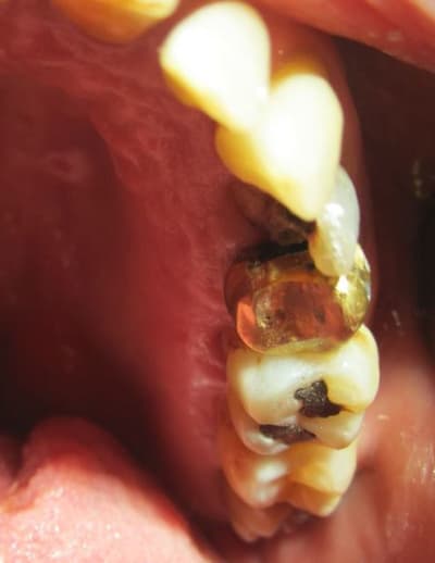 24b gs2zdx - Eugenol