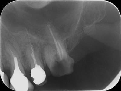 25   lentulo s1s3x4 - Eugenol