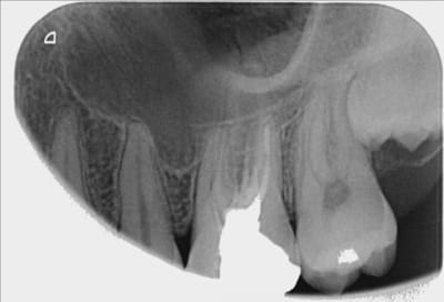 26 avant dxnagy - Eugenol