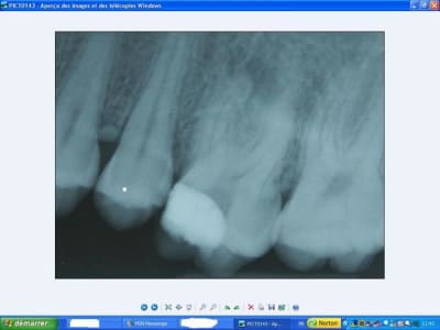 26préop jeoz4o - Eugenol