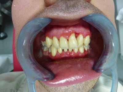 2   11 sept 2012 xdbhqh - Eugenol