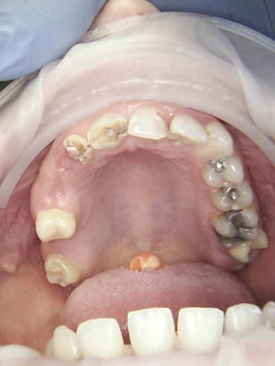 2 phsso3 - Eugenol