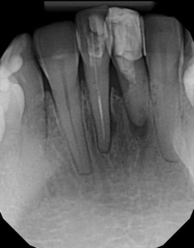31 41 jp143a - Eugenol
