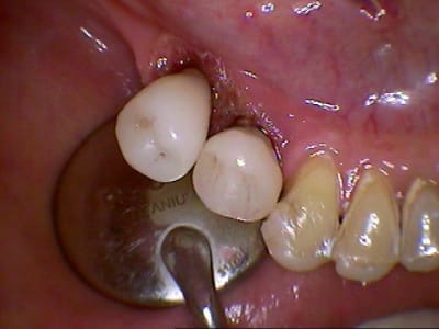 335 roccnm - Eugenol