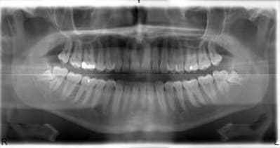 34dents rwnmcz - Eugenol