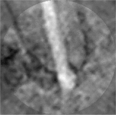 35 dévitalisation a bdxzje - Eugenol