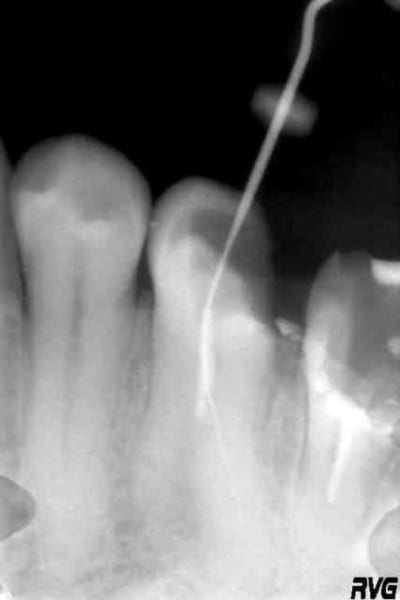 35 zarbi agr0sq - Eugenol