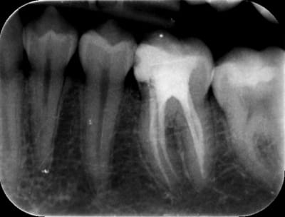 36post bbmcd7 - Eugenol