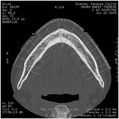 380 za9h30 - Eugenol
