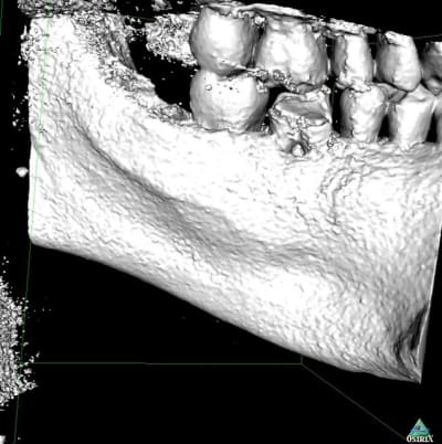 3d2 yi4r0k - Eugenol