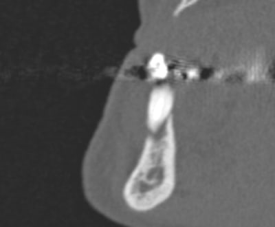 3d4 vr image lcir6s - Eugenol