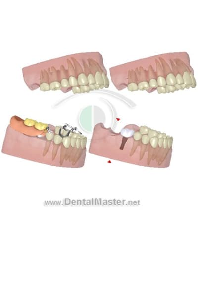 3dscreenshot103 distay - Eugenol