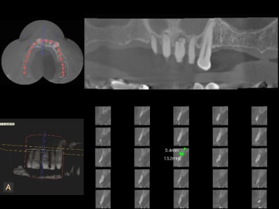 3dslice1 2010 10 28 08 45 12 ltinri - Eugenol