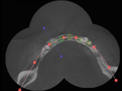 3dslice1 2011 06 19 21 04 11 bxxurs - Eugenol