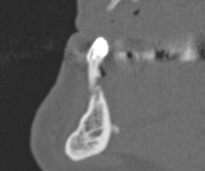 3d vr image qfkztt - Eugenol