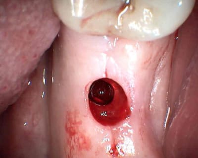 3 abgymj - Eugenol