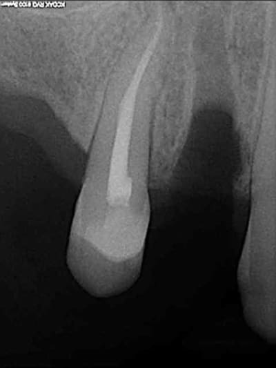 3 apr s extraction s1jkeh - Eugenol